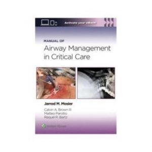 Manual of Airway Management in Critical Care: Print + eBook with Multimedia